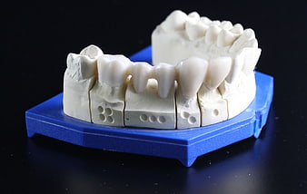 Dental Model With Implant Abutments On Blue Base