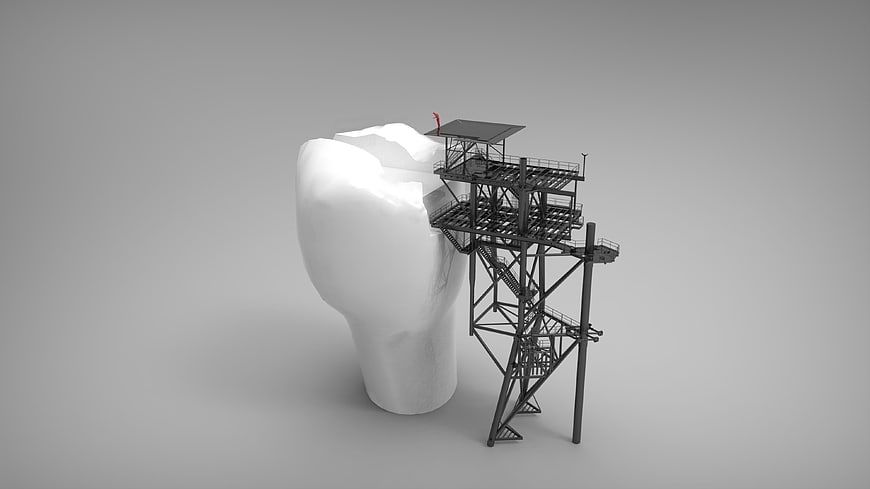 3D Concept of Metal Scaffolding on Giant White Tooth