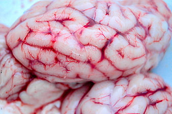 Close-up of human brain with visible blood vessels