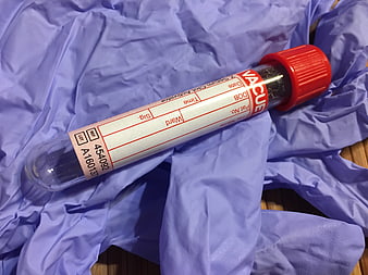 Blood test tube on blue medical glove background