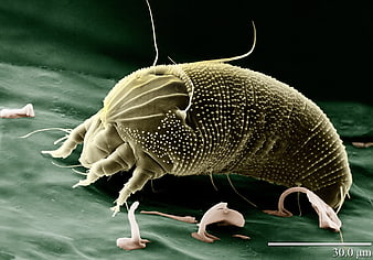 Scanning Electron Micrograph of Eriophyid Mite
