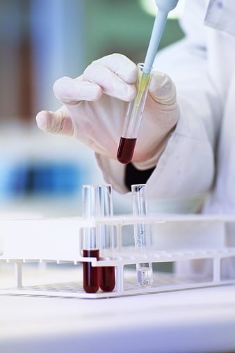 Scientist using pipette with blood sample in laboratory