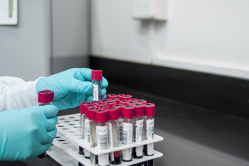 Gloved hands handling blood samples in laboratory rack