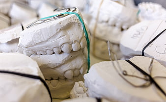 Dental Gypsum Models With Teeth And Rubber Bands