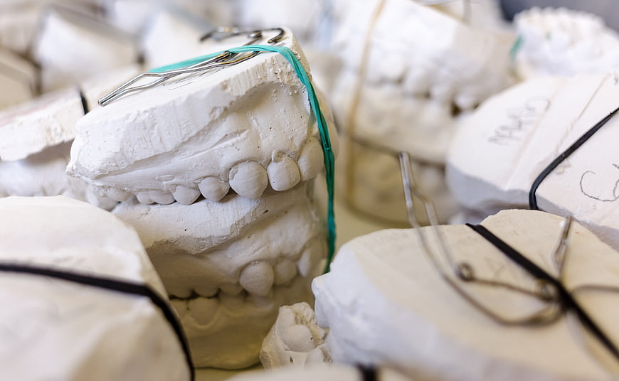 Dental Gypsum Models With Teeth And Rubber Bands