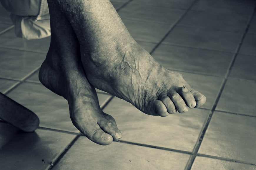 Close-up of elderly feet with visible veins on tiled floor