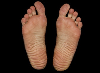 Close-up of wrinkled human soles on black background