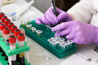 Scientist labeling blood sample tubes in a medical laboratory