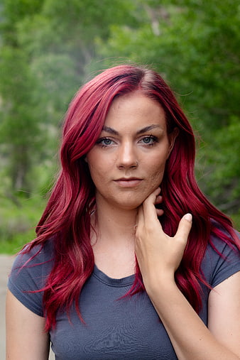 Portrait of Woman with Red Hair and Acne Scars