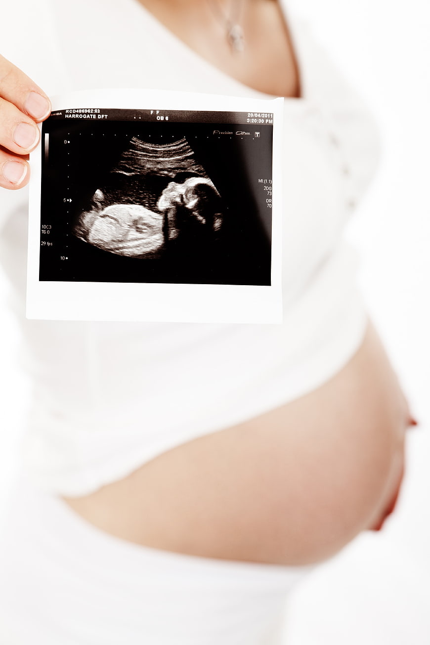 Pregnant Woman Holding Ultrasound Scan Over Belly