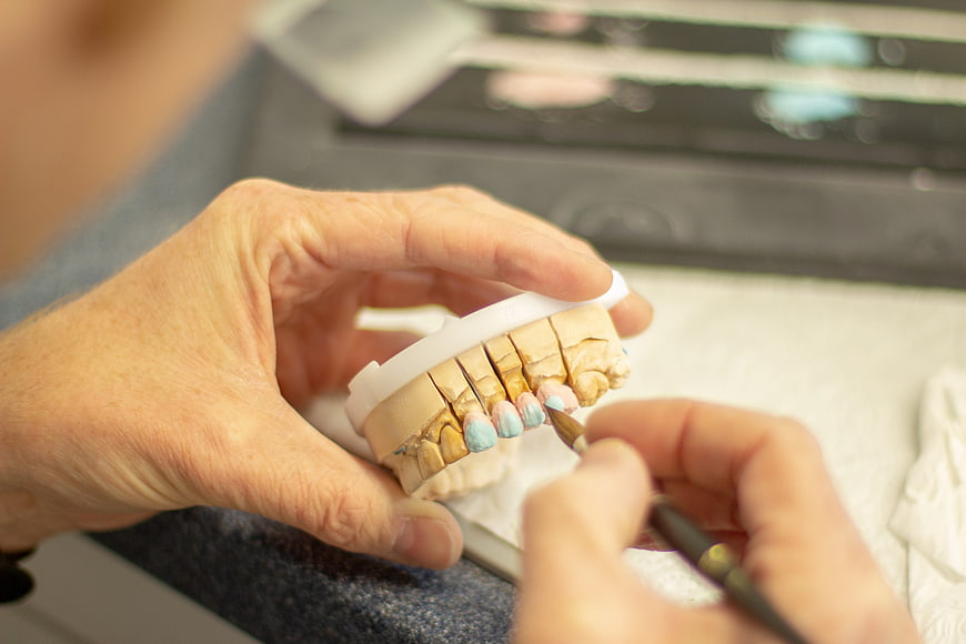 Dental Technician Applying Glaze to Ceramic Teeth Model