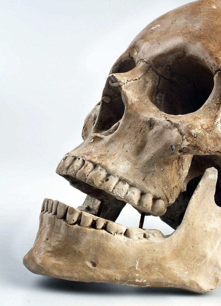 Close-up of Human Skull with Detached Jaw on White Background