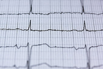 Close-up of ECG electrocardiogram heart rhythm grid paper