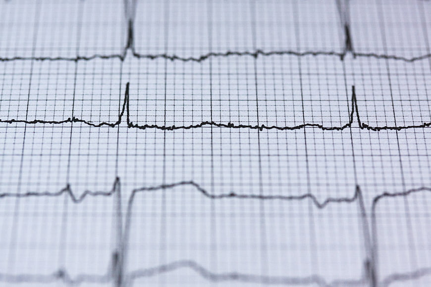 Close-up of ECG electrocardiogram heart rhythm grid paper