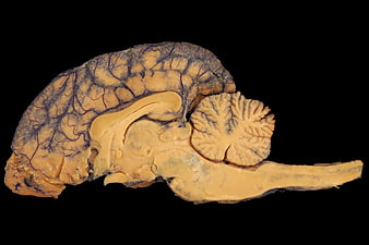 Sagittal section of a preserved animal brain specimen on black background