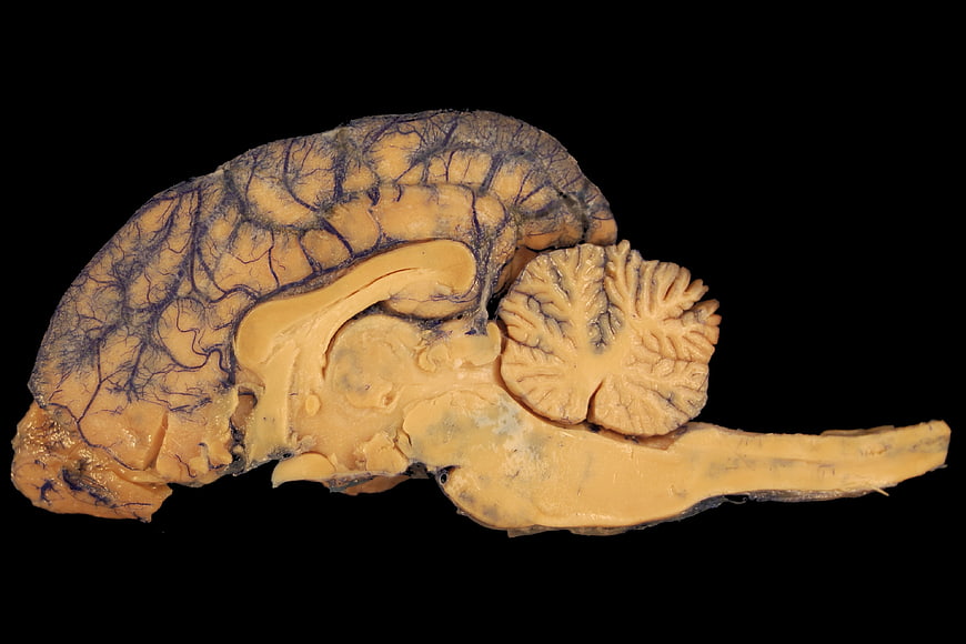 Sagittal section of a preserved animal brain specimen on black background