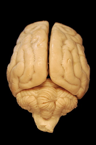 Dorsal View of Preserved Dog Brain Anatomy on Black Background