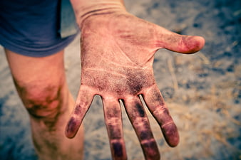 Close-up of dirty hand with scratches and dirt on outdoor background