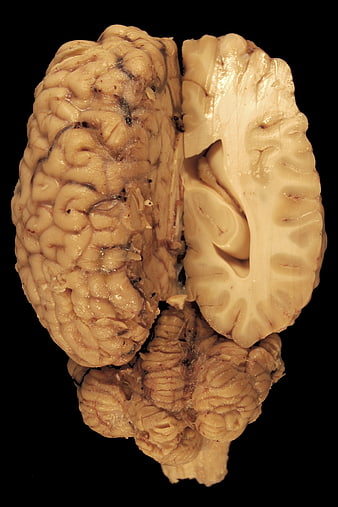 Horse Brain Anatomy Specimen with Cerebrum and Cerebellum on Black Background