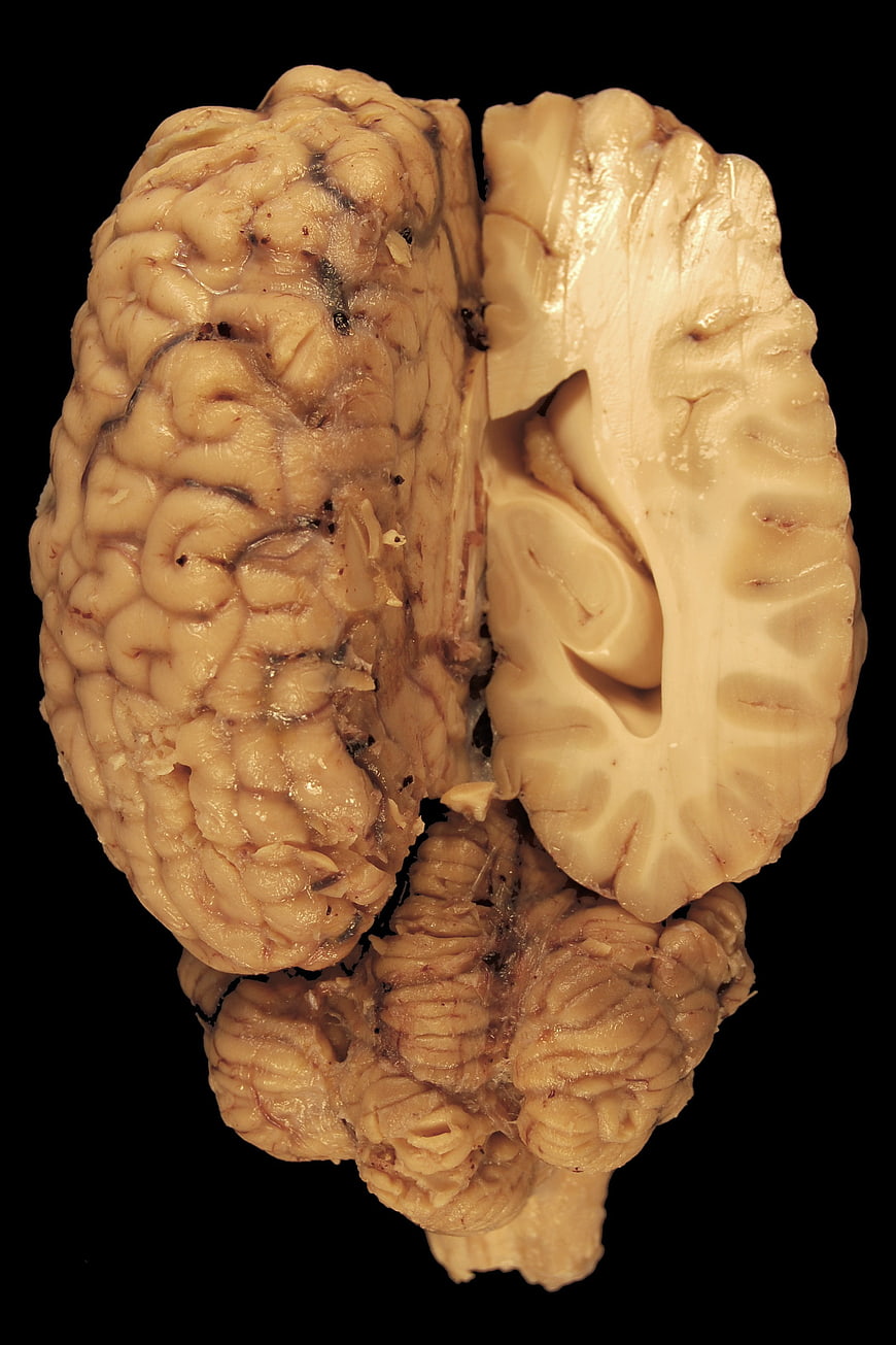 Horse Brain Anatomy Specimen with Cerebrum and Cerebellum on Black Background