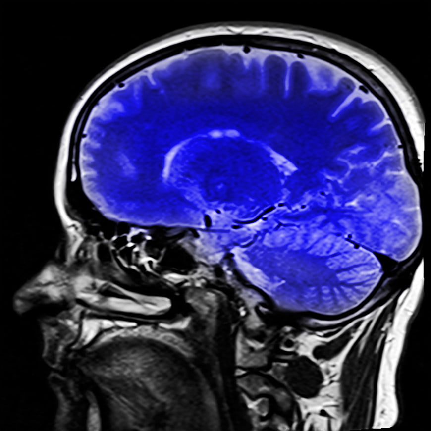 Sagittal MRI Scan of Human Brain with Blue Tint