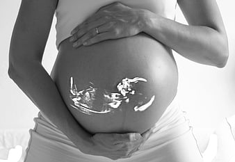 Pregnant woman holding belly with ultrasound gel