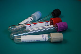 Medical test tubes with colored caps on teal background