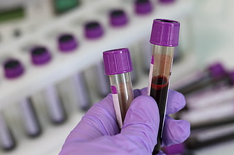 Gloved hand holding blood sample tubes in laboratory