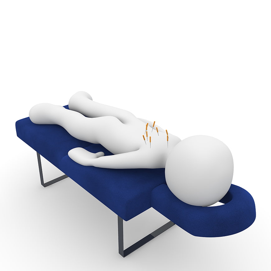 3D Illustration of Acupuncture Treatment on Massage Table