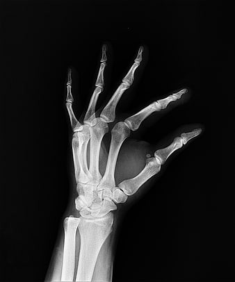X-ray of human hand and wrist bones