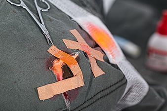 Close-up of bandaged wound with medical scissors and antiseptic