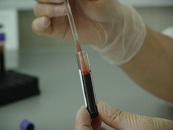 Gloved Hands Transferring Blood Sample in Laboratory