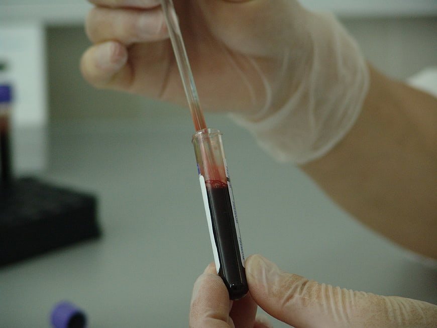 Gloved Hands Transferring Blood Sample in Laboratory